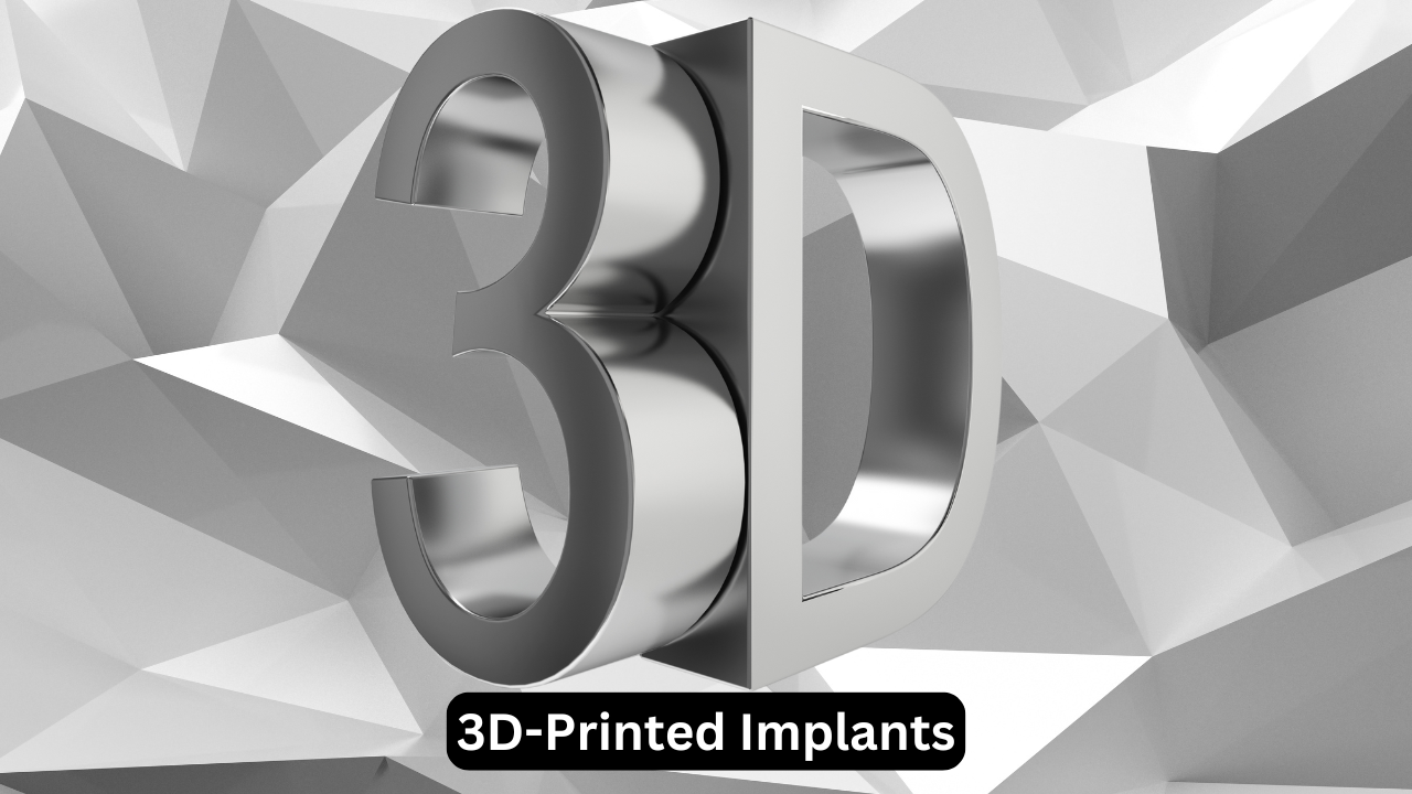3D-Printed Implants